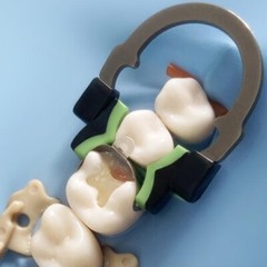 Dental Matrix Band Sectional Matrices Refill Wedge Matrice Plier Clamps Ti Ring