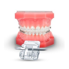 Dental Ormco Damon Brackets Orthodontic Self Ligating Ceramic Metal Roth MBT 022