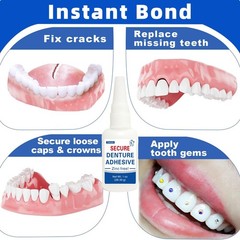 Instant Dental Glue 1 oz – Strong Adhesive for Cracks, Loose Teeth & Dentures, C