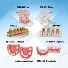Multiple Types Dental Teeth Model Ortho Implant Pathological Perio Practice Demo