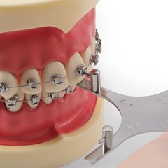 Dental Orthodontic Instrument Bracket Positioner Fully Autoclavable/Reusable