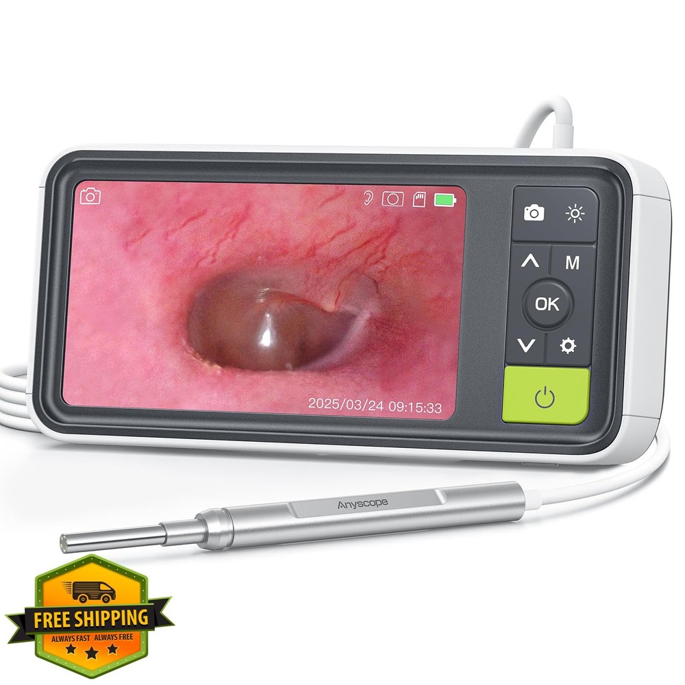 AnyScope Otoscope 1080P Camera 3.9mm Ear Scope