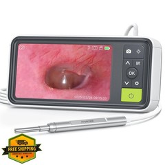 AnyScope Otoscope 1080P Camera 3.9mm Ear Scope