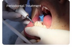 Dental Ultrasonic Piezo Scaler fit EMS Woodpecker Handpiece + Auto Water Supply