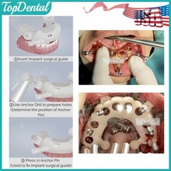 USA Dental 3DDX Fixation Drill Locator Tool Implant Denture Plate DSG ⌀1.5x20mm