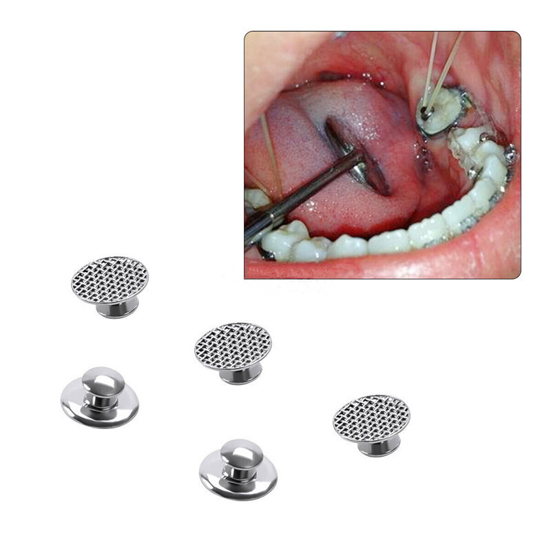 50 Pcs Dental Orthodontic Bondable Metal Lingual Buttons Round Mesh Base Split