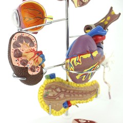 Medical Anatomical Human Diabetes Model 8 Parts Shows The Harm Of Diabetes