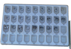 molar bands