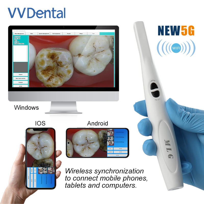 Dental Wireless Oral Viewer Intraoral Camera 1080p HD Intra Oral Camera