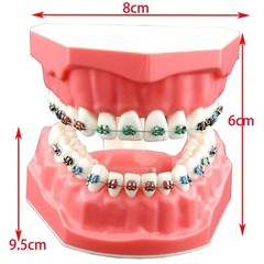 US Dental Typodont Teeth Model with Orthodontic Brackets Brushing