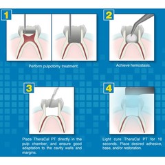 Dental THERACAL PT DC Resin Modified Calcium Silicate Material 4gm Syr & 15 Tips