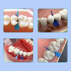 Dental Matrix Bands Ring Sectional Matrice Clamp Fit Garrison Palodent V3 System
