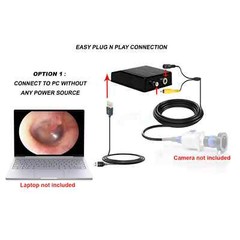 USB adaptor for ESC Medicams Portable Endoscopy Camera ENT-2000P for PC Laptop