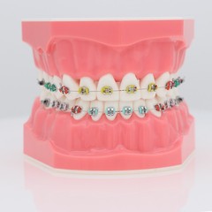 US 1:1 Dental Orthodontic Teeth Model Typodont Demonstration Model with Brackets