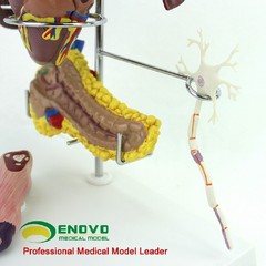 Medical Anatomical Human Diabetes Model 8 Parts Shows The Harm Of Diabetes