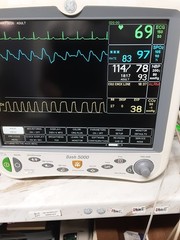 GE Dash 5000 massimo sp02 and soft 7.3 with 4 IBP and Co2 , 90 DAYS FREE RETURN