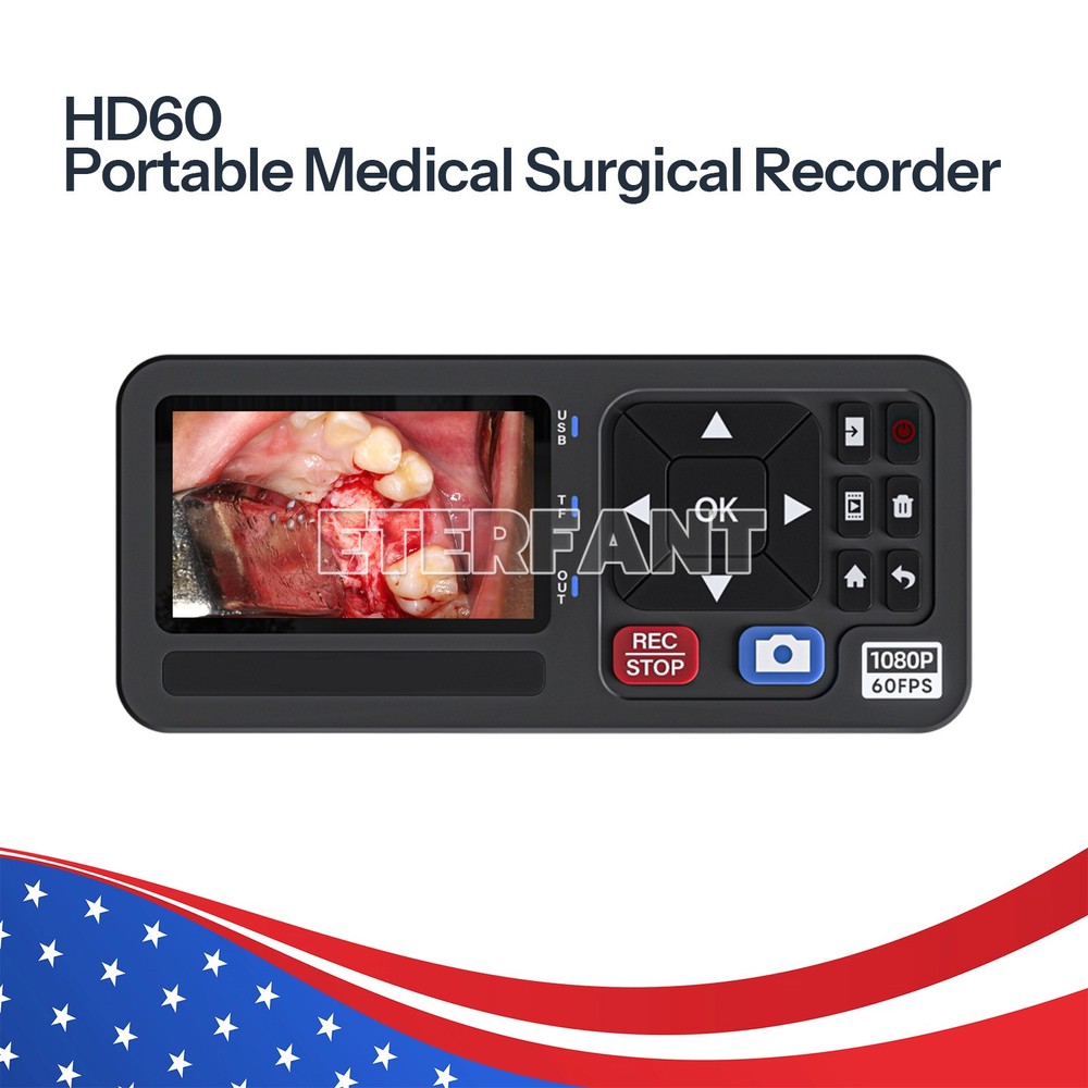 1080p Full HD Endoscopy Camera/Surgical Recorder For Medical ENT Laparoscopy