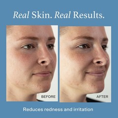 Otella Detox Soothe Face Mist Hypochlorous Acid .02 2.7 Oz Helps Reduce Redness
