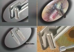 SS Meibomian Gland Eye Forceps B Batlle Expressor Remove Deep Meibum Dry Lids