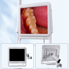 17 Inch Dental Intra Oral Camera 16 Megapixel Intraoral LCD Monitor With Holder