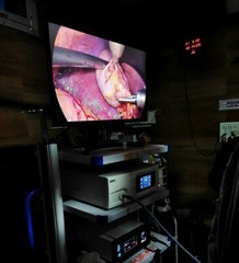 Laparoscopic Camera for Surgical Laparoscopy Endoscopy Full HD Endoscope Systems