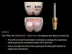 Lateral Window Sinus Elevation Drill Set, with elevator instrument set