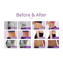 9 in 1 Beauty Machine for Body Massage Facial Skin Care Skin Lifting Lost Weig3