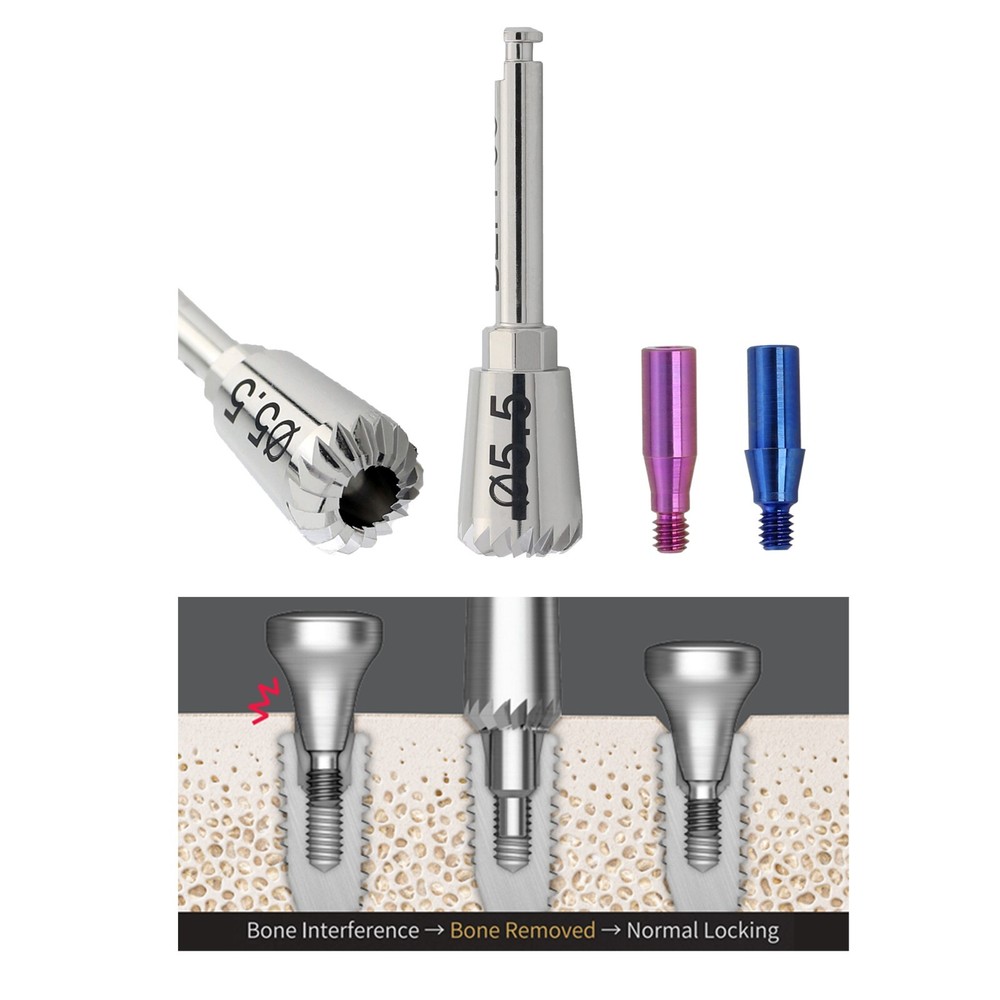 Dental Implant ET Bone Profiler 5.5 & Guide Screws Mini Regular Hiossen OSSTEM