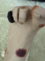 VATA Wilma Wound Foot Teaching Model