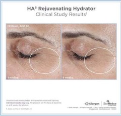 NEW Sealed SkinMedica HA5 Rejuvenating Hydrator – 2 oz.~ Authentic