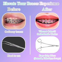 Dental Braces Color Changing Kit with Orthodontic Plier, 5 Rolls Brace Power …