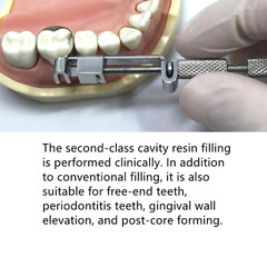 Dental Universal Matrix Band Tofflemire Stainless Steel Matrice Forming Pieces