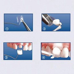 Dental Preformed Crown Resin Temporary Pre-corona Transparent Anterior 1.910