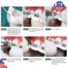Dental Orthodontic Wire Preformed/Kobayashi Ligature Ties Stainless Steel AZDENT
