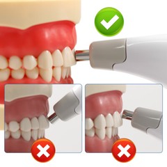 Dental LED Digital Shade Guide Tooth Color Comparator Equipment Teeth Whitening