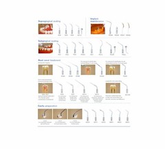Woodpecker DTE D600 LED Dental Ultrasonic Scaler Scaling Perio Endo Treatment