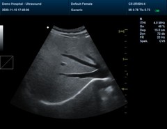 Ultrasonic Diagnostic System abdomen/convex probe CONTEC CMS600P2 PLUS+Free PW