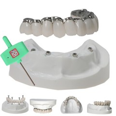 Dental Implant Model Upper Lower Jaw Demo All on 4/6 Overdenture treatment model