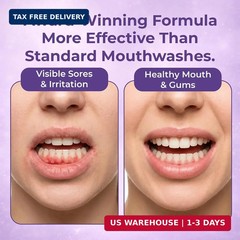 Oral Rinse Mouthwash for Dry Mouth Mouth Sores Relief Alcohol Free Mint 1 L