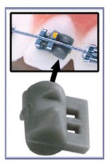 ROTATION WEDGES Orthodontic Rotator Elastic – 100 per Pack BARRIL DE ROTACION