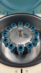 HETTICH EBA 280 Benchtop Centrifuge w/ 1142 Rotor – Free Shipping
