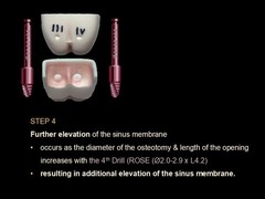 Lateral Window Sinus Elevation Drill Set, with elevator instrument set