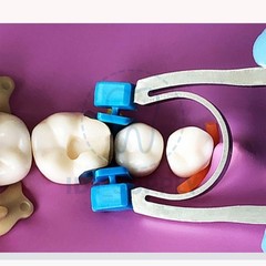 Dental G3 G4 Sectional Matrix Kit 30 Bands Clamp Ring Holder Composite Filling