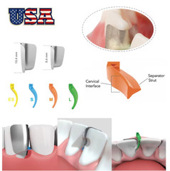 200Pcs/Box Dental Anterior Matrix System Wedge Matrix Bands Interdental Wedges