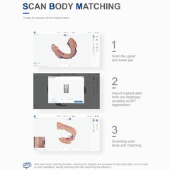 Dental Scanner 3D Real-time Display w/ AI Scanning Software + 4 Tips