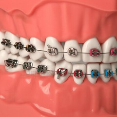 US Dental 1:1 TypodontTeeth Model Orthodontic with Metal Brackets Brace M7010-2