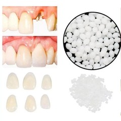 Dental Thermal Beads Replacement Temporary 25g ﻿Tooth Denture False Repair Tool