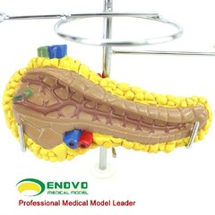 Medical Anatomical Human Diabetes Model 8 Parts Shows The Harm Of Diabetes