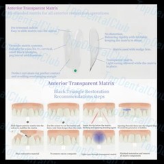 1Kit Dental Clear Matrix BT Bow Tranparent Matrices Fit BioClear Black Triangle