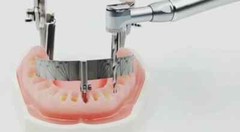 original julldent All on 4 Guide for multiple placement of implant FREE SHIPPING